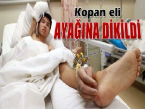 KOPAN ELİNİ AYAĞINA DİKTİLER